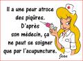 Bienfaits de l'acupuncture...